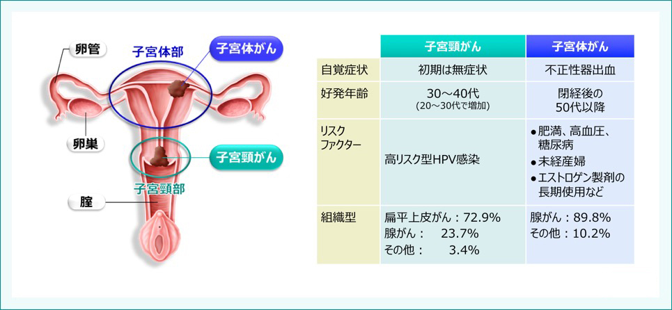 ゴールデングラブ賞 大谷