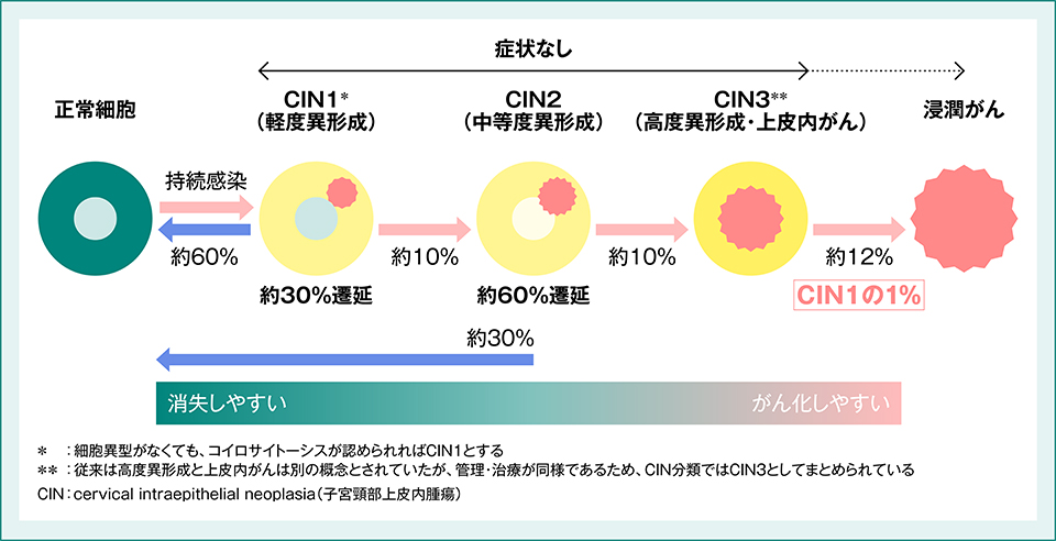 隈研吾 ワイヤー