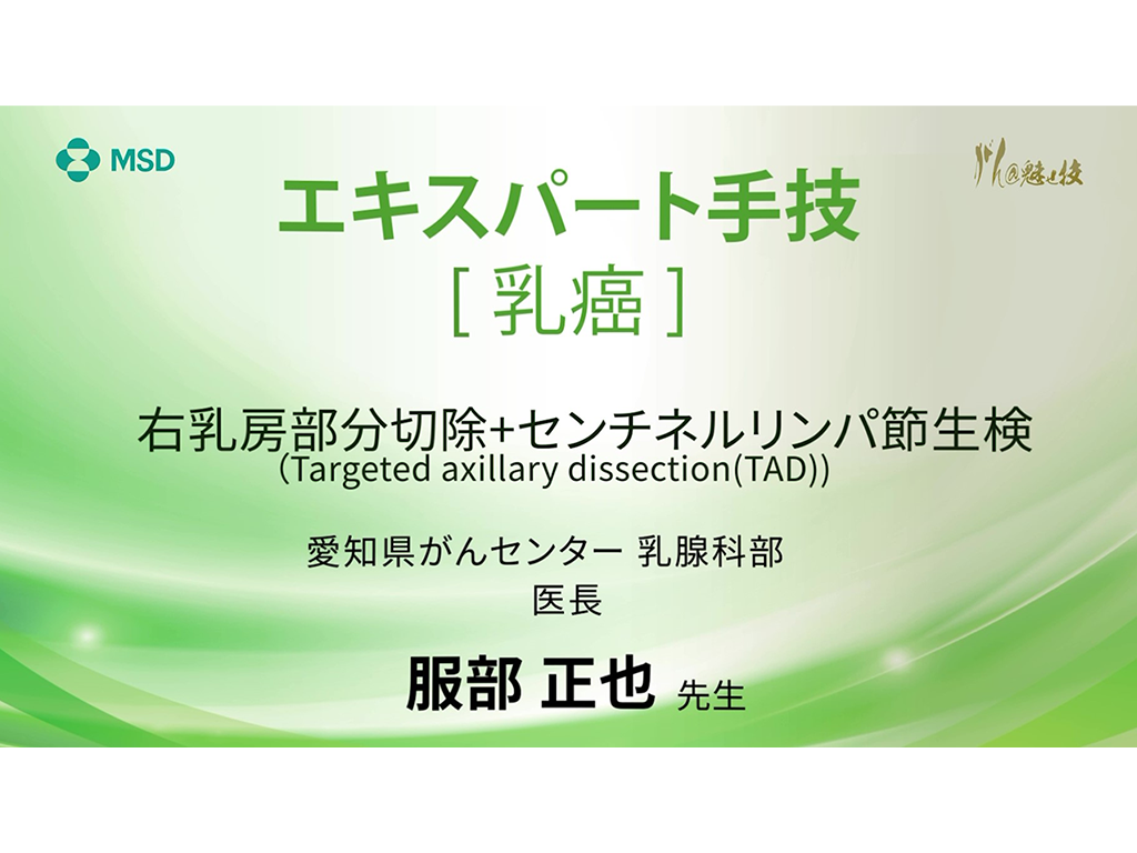 【乳癌】エキスパート手技 右乳房部分切除+センチネルリンパ節生検（Targeted axillary dissection (TAD)）